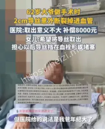 介入手术导丝意外